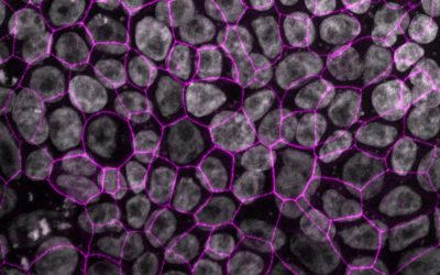Novel lung model to test drugs and understand infections