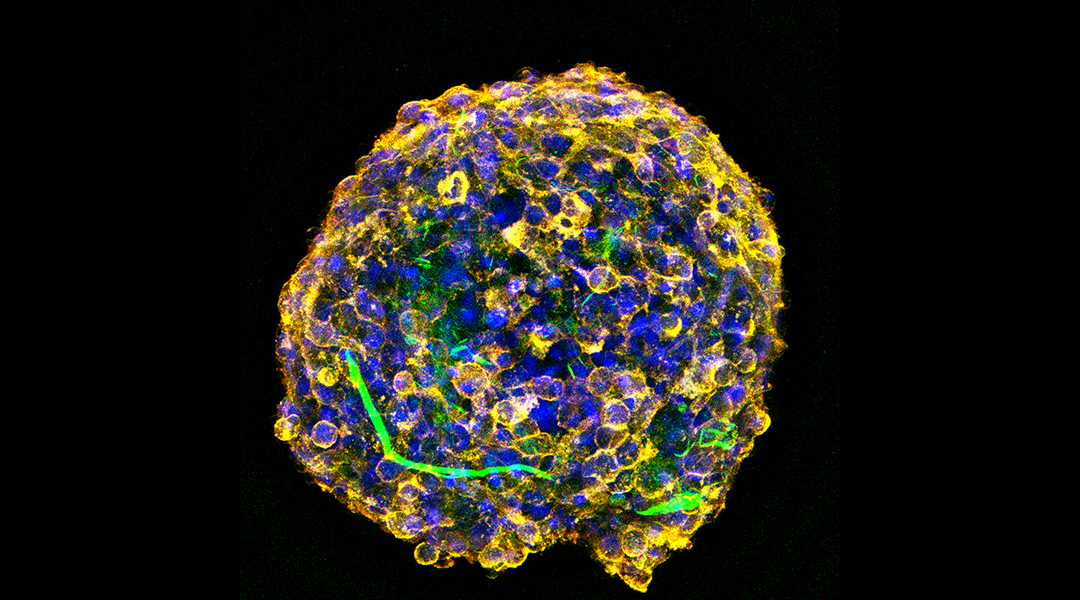 Cell spheroid