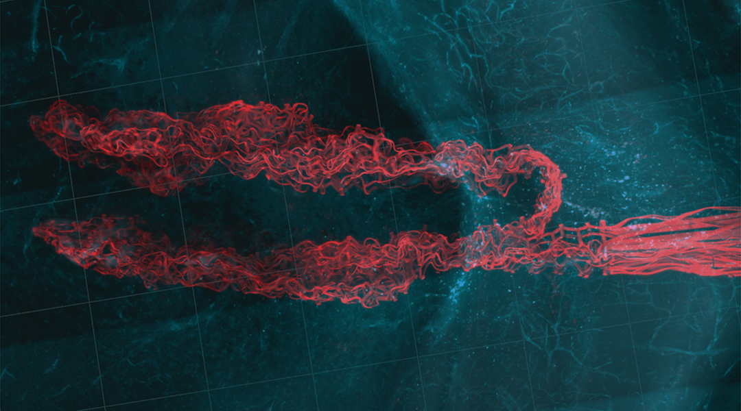 Images of a neurological probe to investigate the brain.