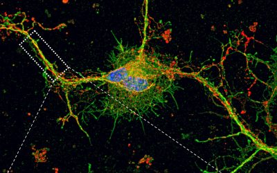Scientists identify a new molecular mechanism for autism