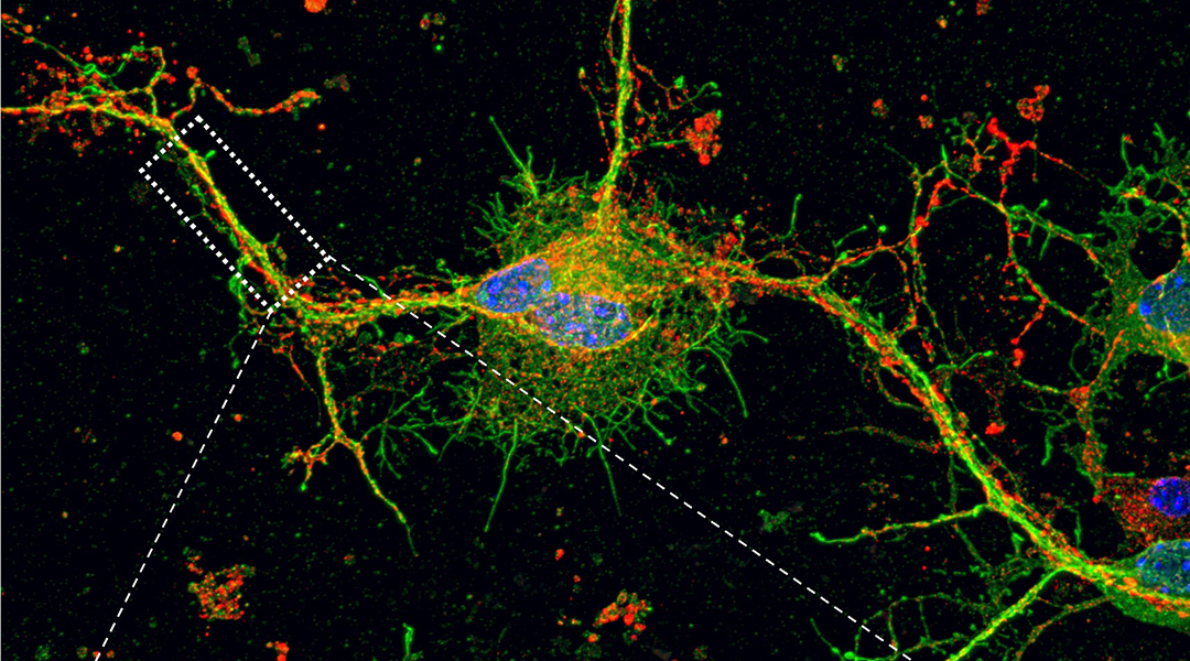 A confocal microscopy image of synaptophysin expression in Shank3 mutant primary cortical neurons.