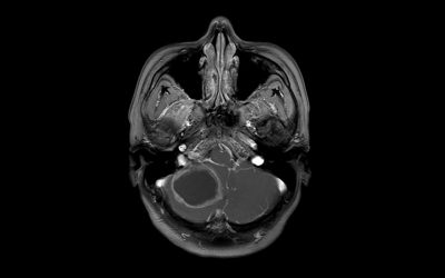 Using bacterial infections to help treat brain tumors