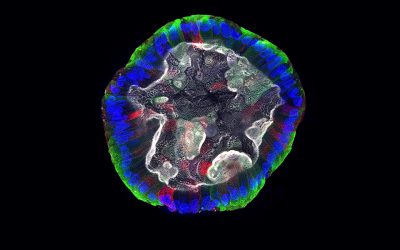 Using organoids to advance equity and inclusion in drug discovery