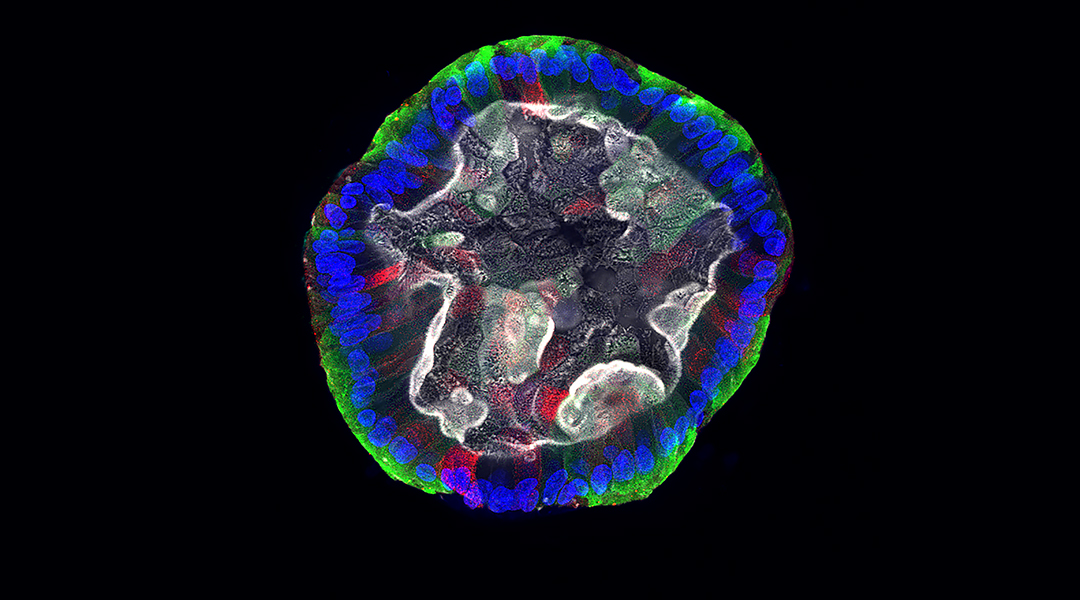 A differentiated organoid on a black background.
