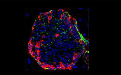 How our cellular “antennas” affect aging