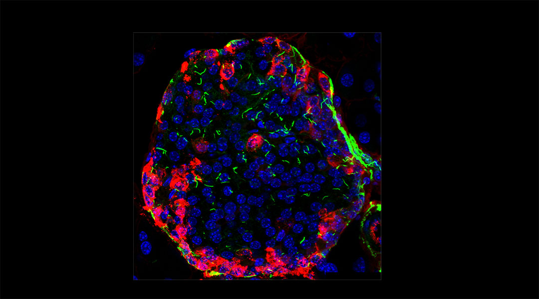 A pancreatic islet