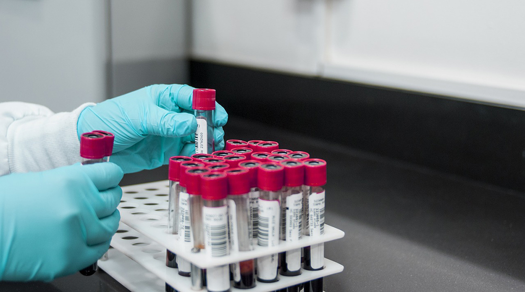 Vials of blood samples in a lab.