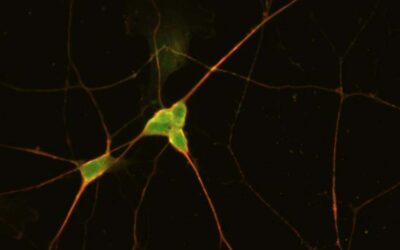 First ever human-based model for opioid overdose and recovery