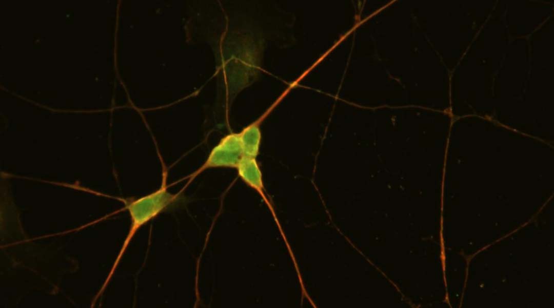 Immunofluorescent image of iPSC-preBötC neurons.