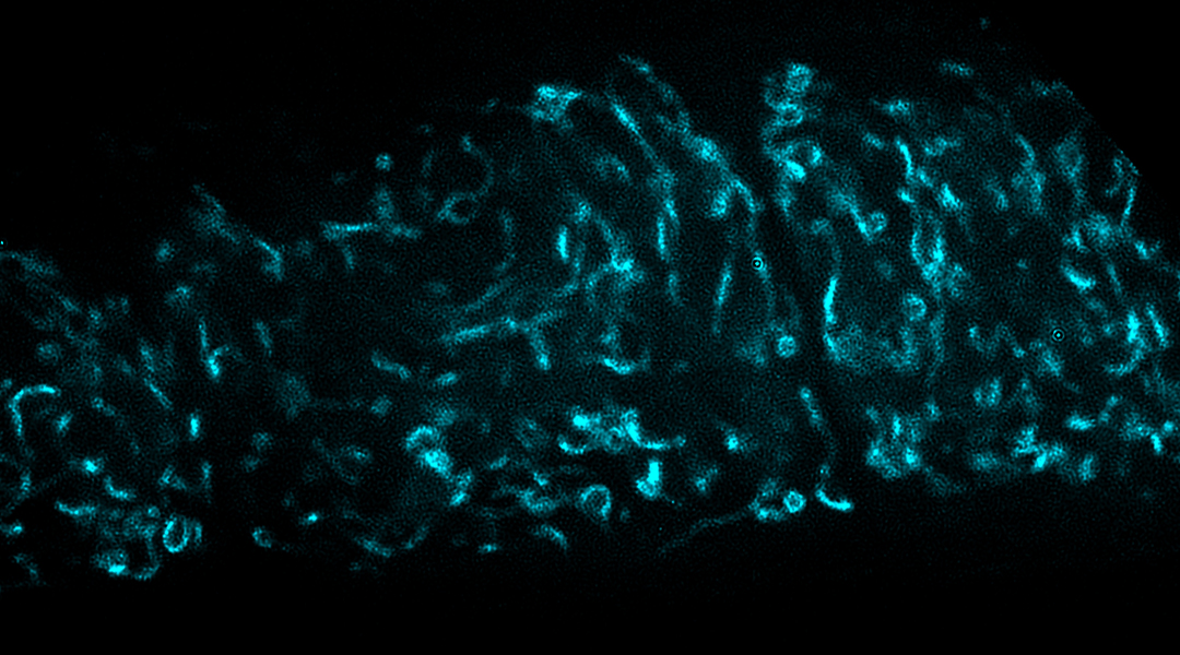 Oocyte lab image.