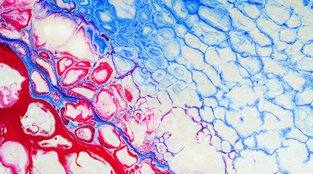 Abstract fluid art looks like blood vessels.