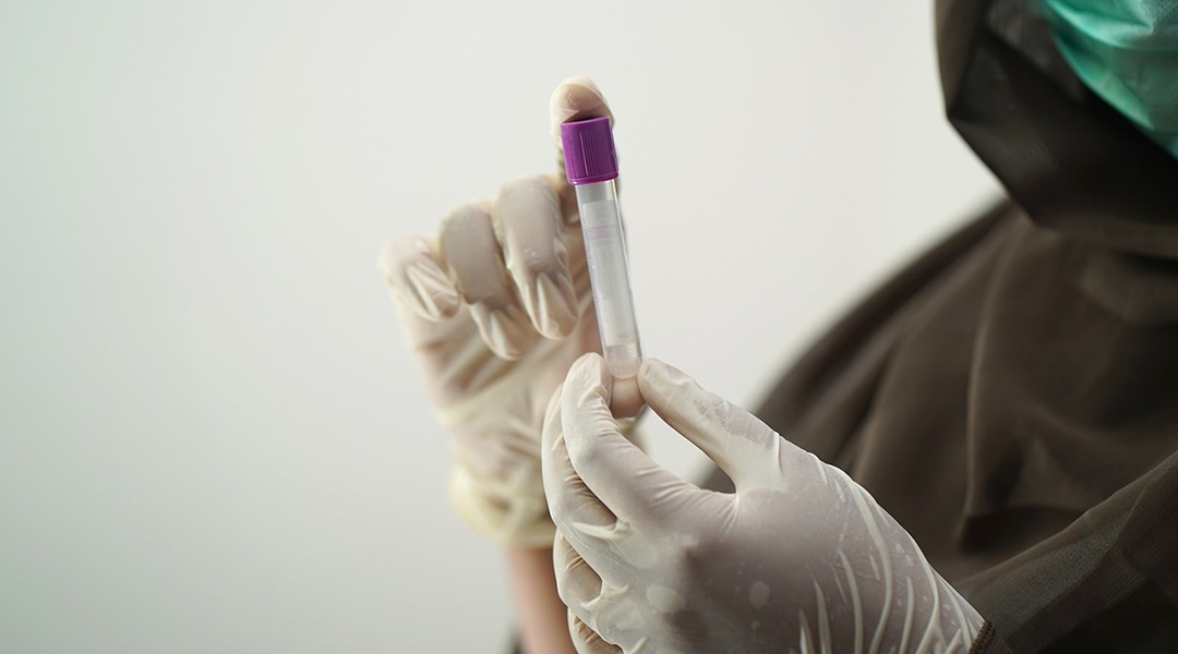 A blood sample