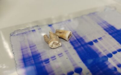 Centuries-old antibodies recovered from ancient teeth