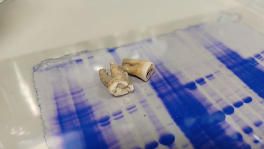 Teeth extracted from a skeleton from which whole antibodies were isolated.