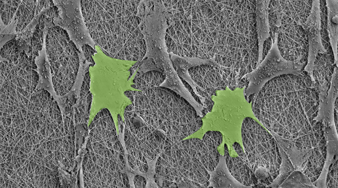Stem cells growing on a piezoelectric surface.