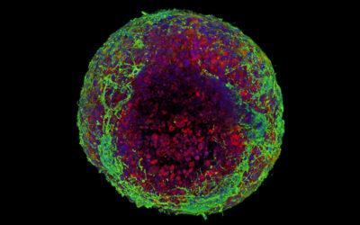 Creating realistic “squishy” brain tissue in the lab