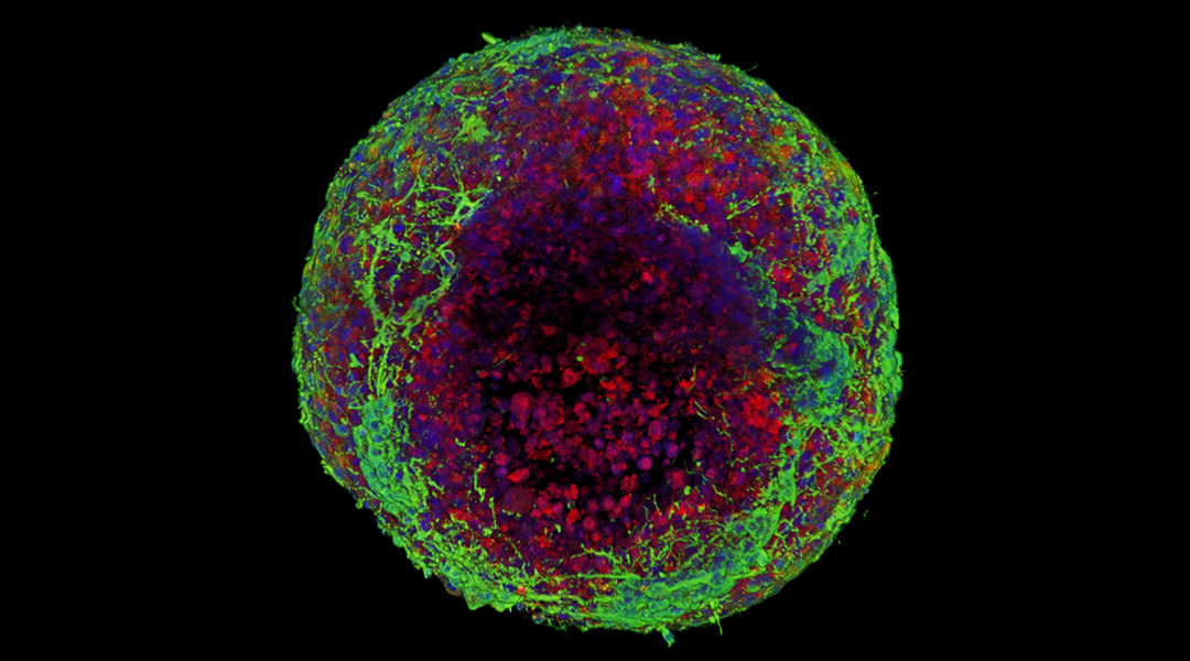 Experimental image of a synthetic brain.