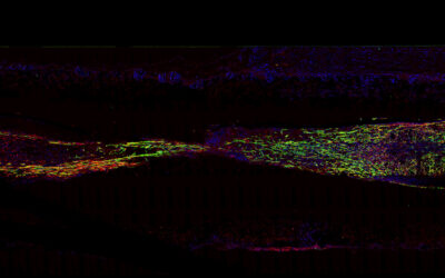 A biodegradable scaffold repairs nerve damage in mice