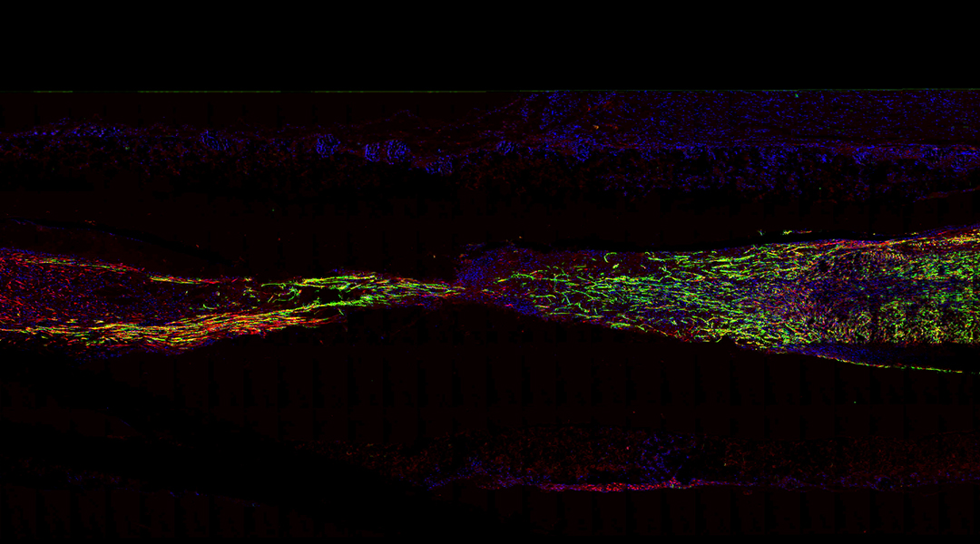 A biodegradable scaffold repairs nerve damage in mice