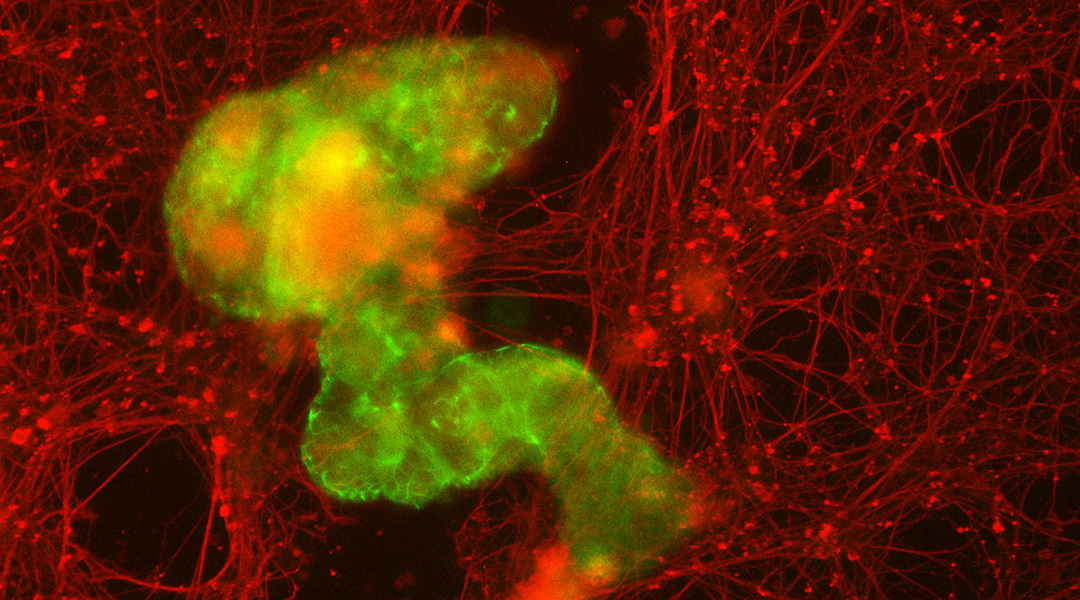 Cells growing on a microgel scaffold.