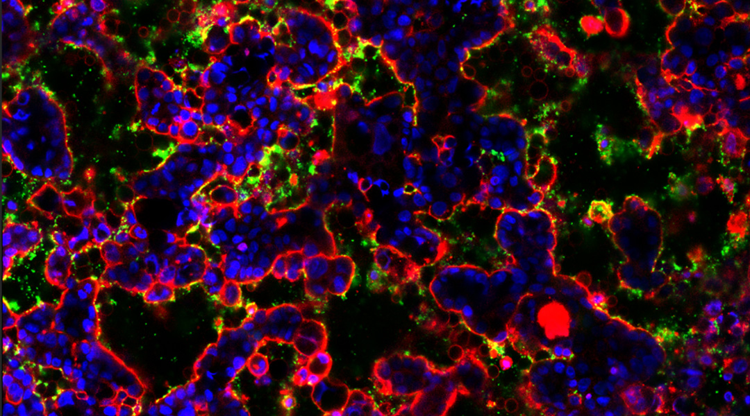 Experimental image of an artificial gut model.