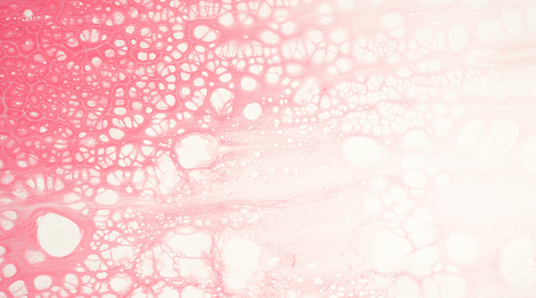 Abstract image of pink and white blobs.