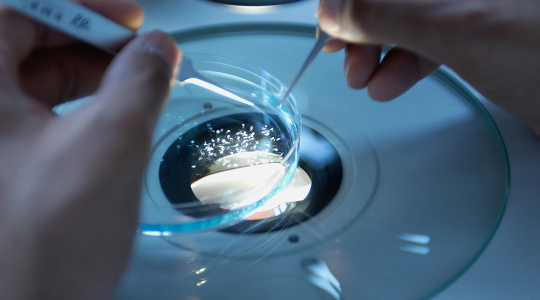 A petri dish under a microscope.