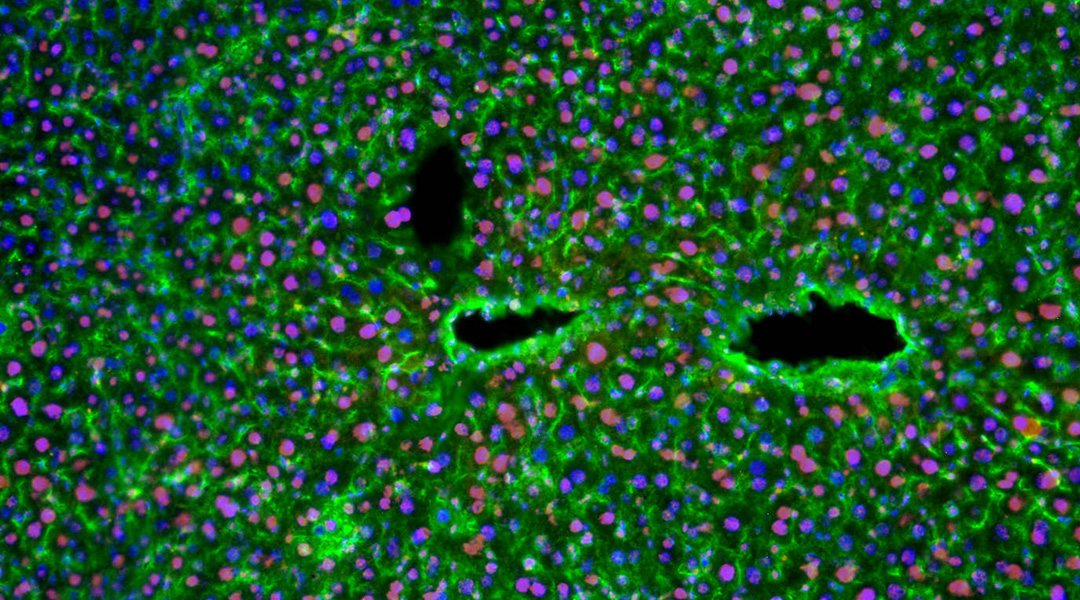 Amyloid beta in liver cells.