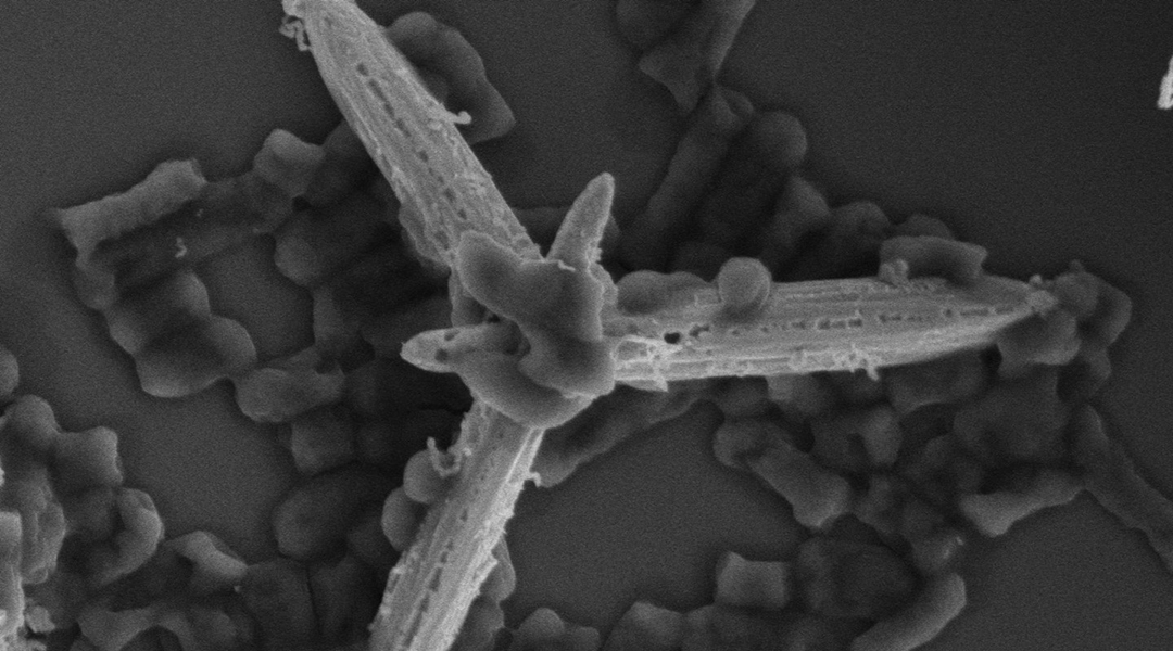 A tiny, self-propelled motor to kill bacteria.