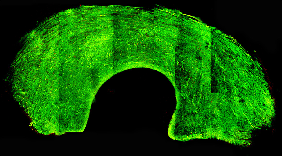 Frozen knee graft experimental image.