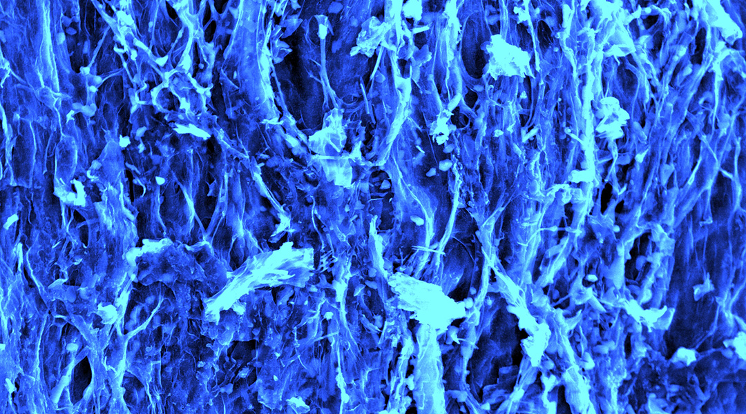 Carbon network derived from fungi.