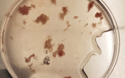 Nanoparticles disrupt placenta, potentially affecting fetal development