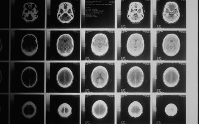 AI trained on brain scans could better predict mental health issues in adolescents
