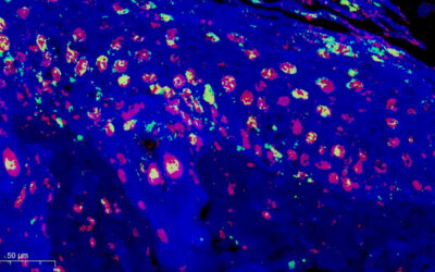 Zwitterions speed up healing in diabetic wounds