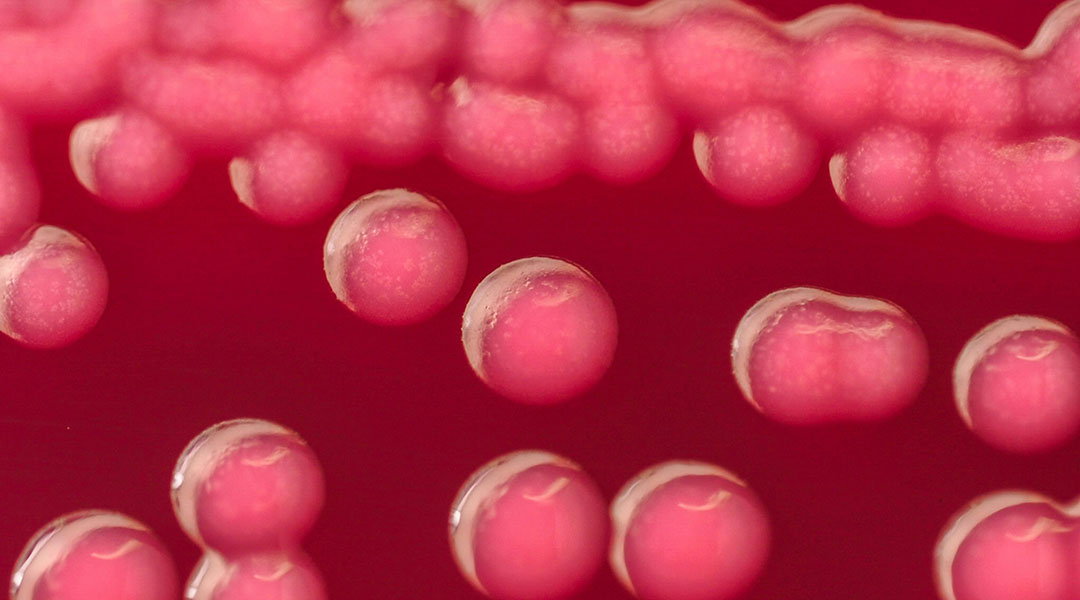 Common bacteria could be used to produce biodegradable bioplastics