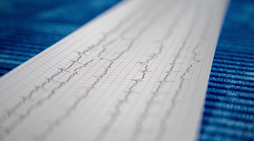 World’s smallest pacemaker dissolves once it’s no longer needed
