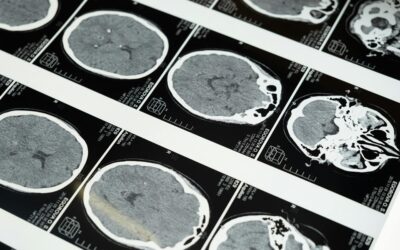 Epigenetic changes tie brain maturation to adolescent cognitive gains