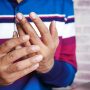 A man's hands suffering from rheumatoid arthritis