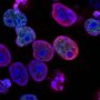 Cancerous cells