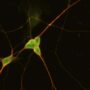 Immunofluorescent image of iPSC-preBötC neurons.