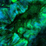 Image of the ovarian cancer microenvironment.