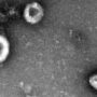 TEM image of cells.